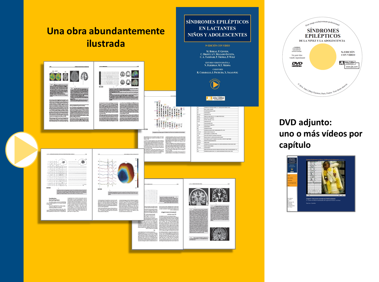 visuel sindromes